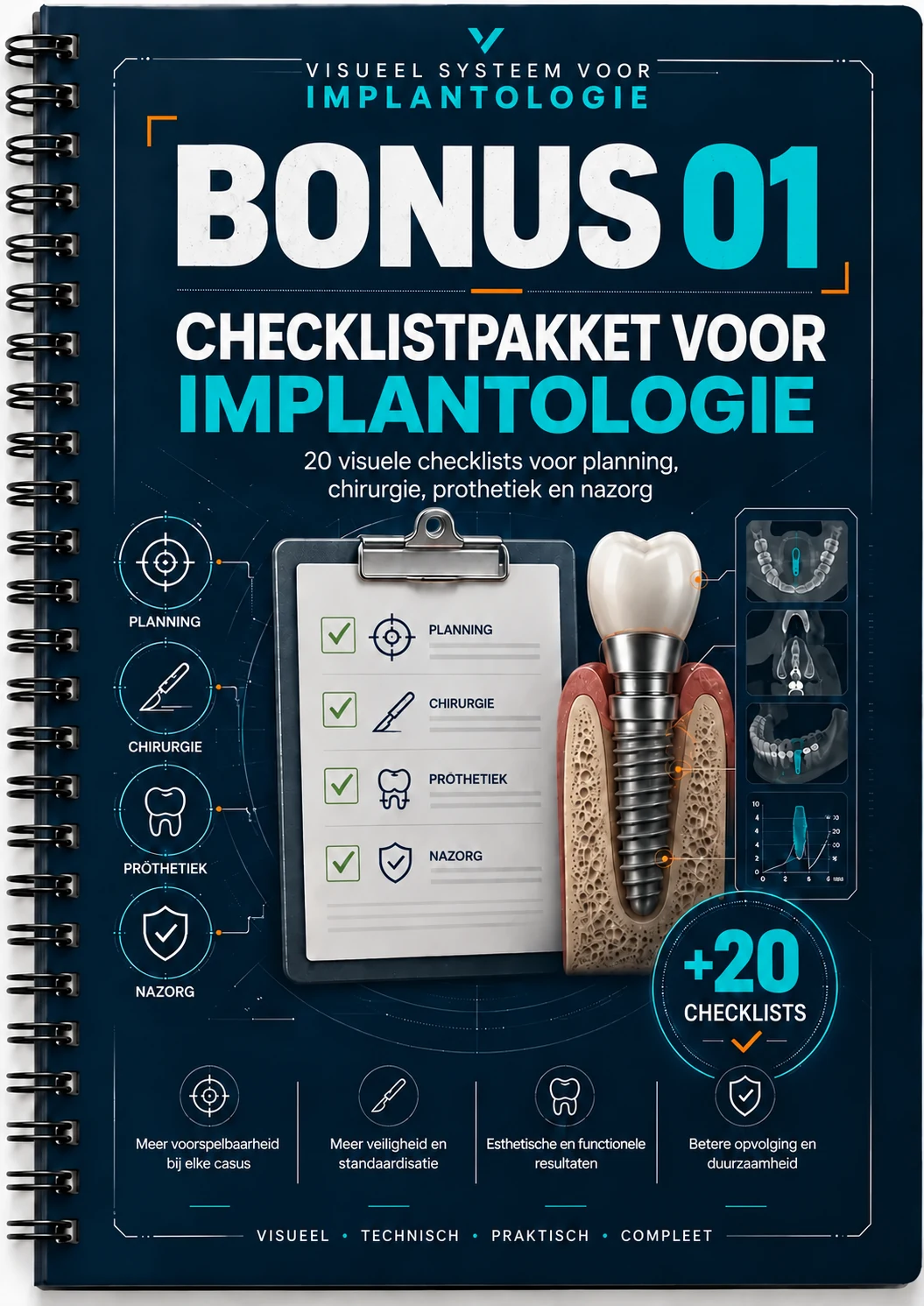 Checklistpakket voor implantologie