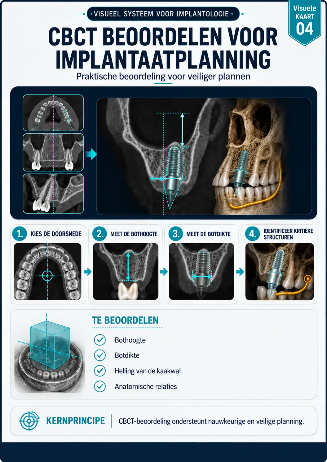 CBCT-beoordeling voor implantaatplanning