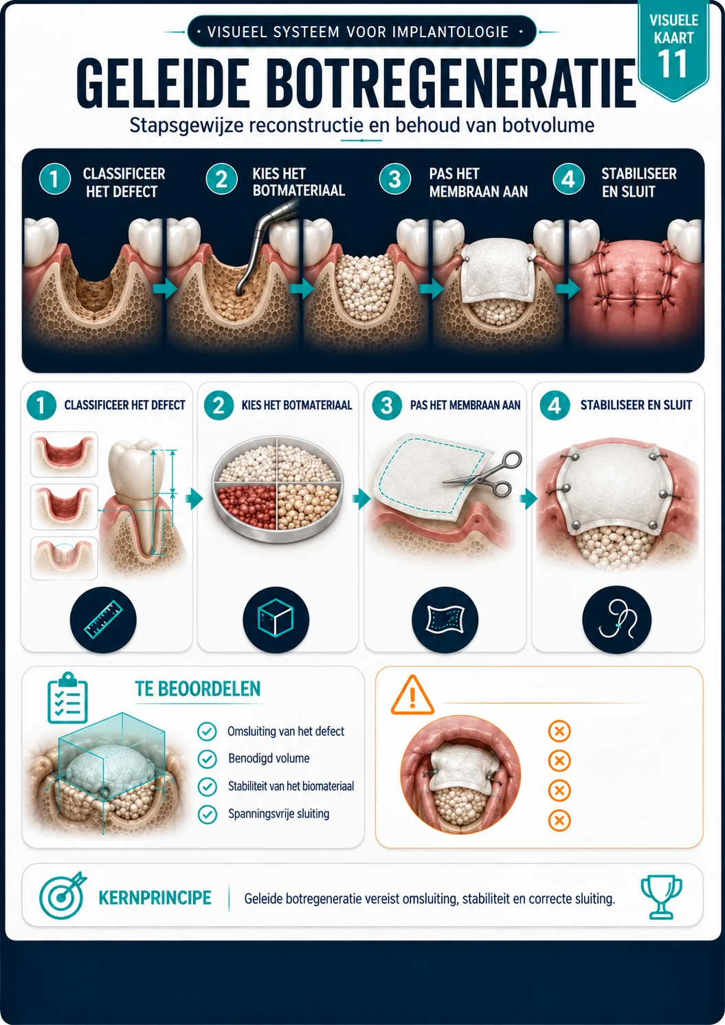Geleide botregeneratie (GBR)