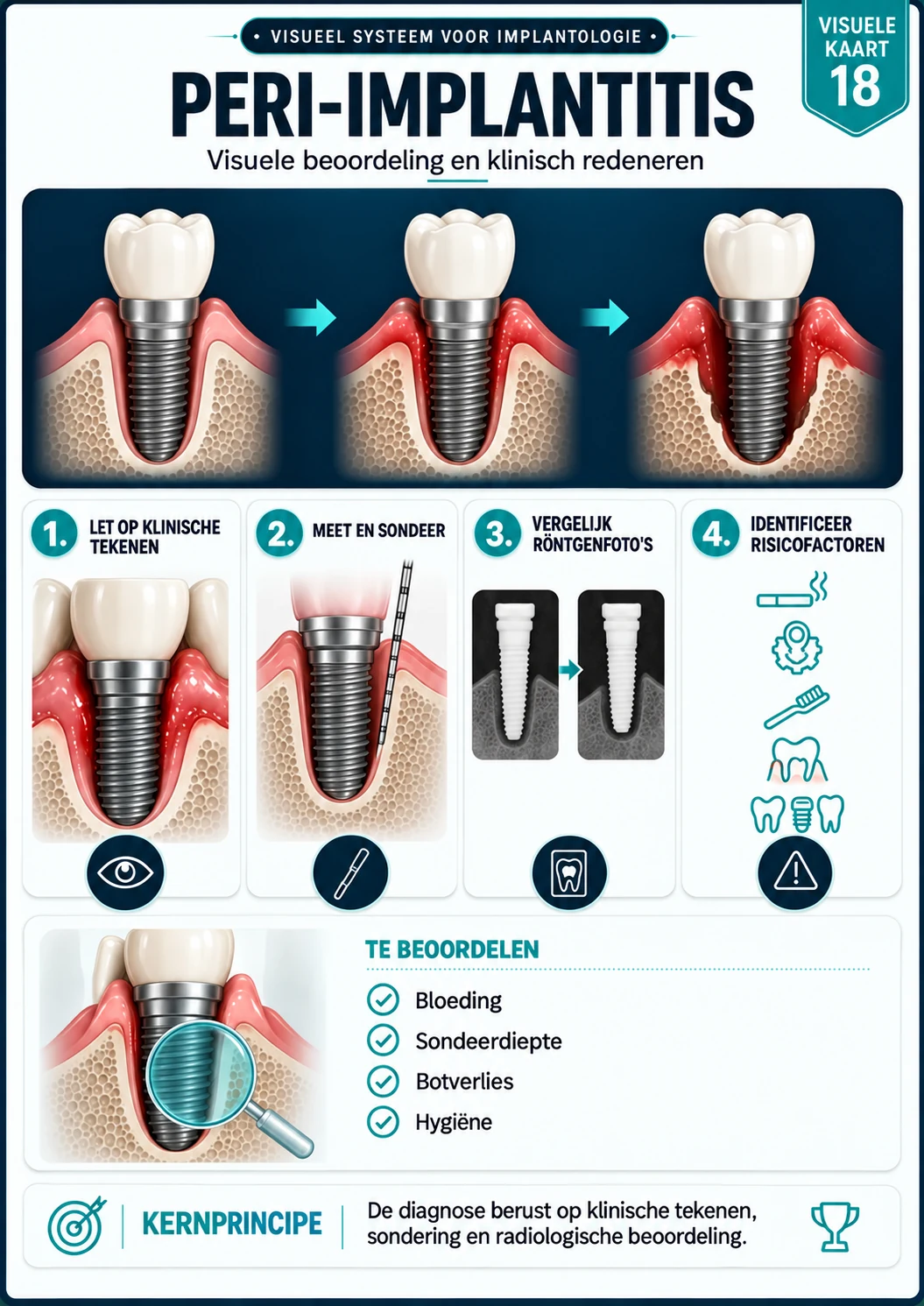 Peri-implantitis